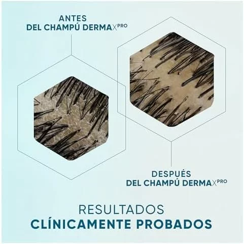 Pack de 6 champús anticaspa H&S DermaXPro calmante 300 ml