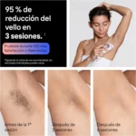 Braun Smart IPL Skin i·expert PL7230 depiladora de luz pulsada